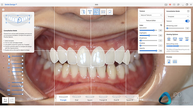 Digital Smile Design Institute Of Digital Dentistry