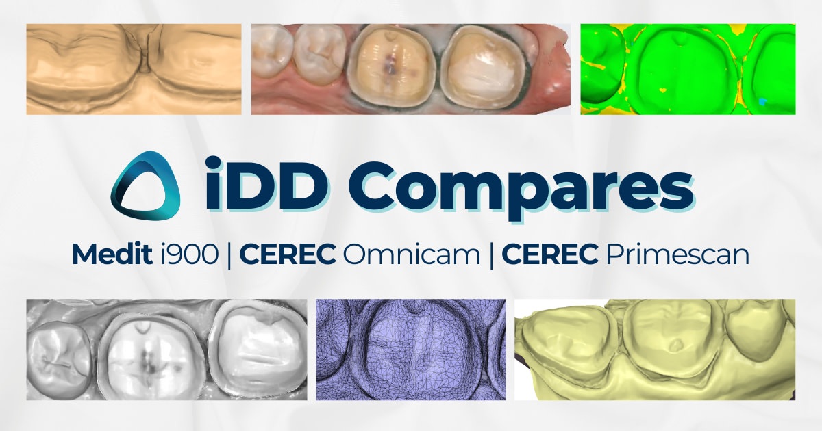 CEREC Omnicam Vs CEREC Primescan Vs Medit I900