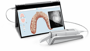 align-itero-element-5d-itero-element-5d-wand-intra-oral-scanner-ids-2019-institute-of-digital-dentistry-500x281