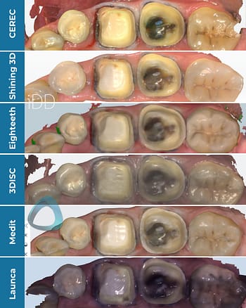 crown-prep-tooth-scan-test-color-render-Shining-3D-Aoralscan-3-vs-CEREC-Primescan-vs-Helios-600-vs-medit-i700-vs-launca-dl-206p-intraoral-scanner-comparison