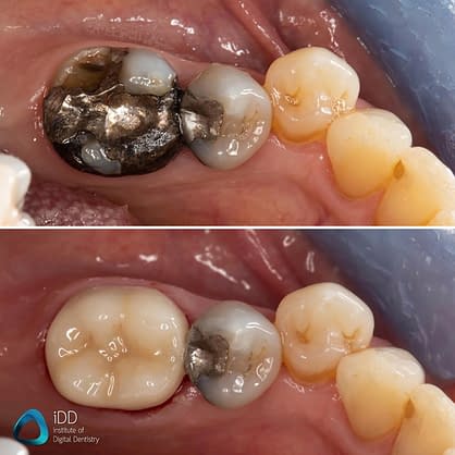 CEREC Primescan and Primemill Review - Institute of Digital Dentistry