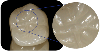 Zirconia crown close up after polishing material institute of digital dentistry
