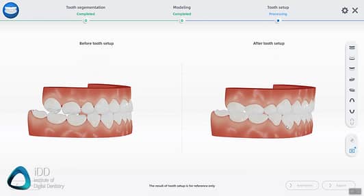 aoralscan-3-review-shining-3d-orthodontic-simulator-model-builder (17)