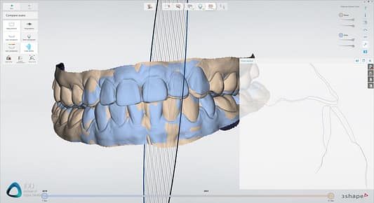 Patient Monitoring 3Shape TRIOS Institute of Digital Dentistry (1)
