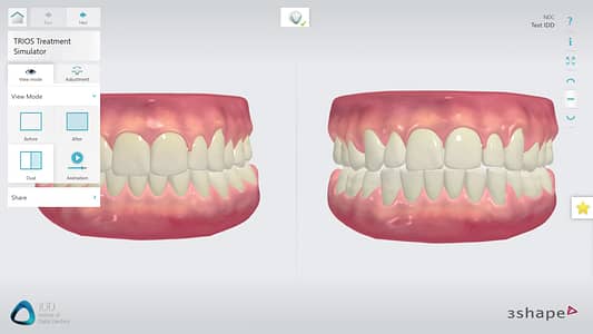 3shape_unite_platform_institute_of_digital_dentistry_TRIOS (14)
