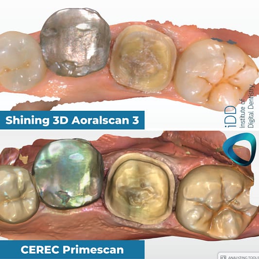 metal-tooth-scan-test-color-render-Shining-3D-Aoralscan-3-vs-CEREC-Primescan-intraoral-scanner-comparison