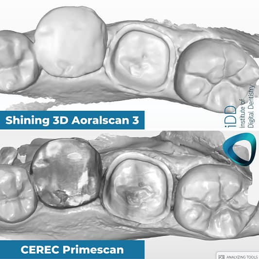 metal-tooth-scan-test-mono-render-Shining-3D-Aoralscan-3-vs-CEREC-Primescan-intraoral-scanner-comparison