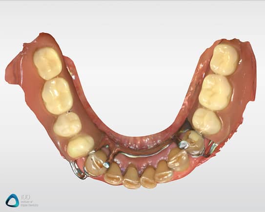 CEREC Full arch scans Primescan review institute of digital dentistry (1)