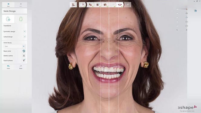 3Shape-TRIOS-smile-design-software-institute-of-digital-dentistry