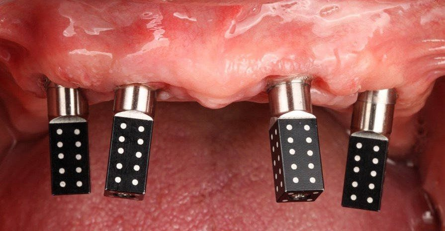 Fig.1+Photogrammetry+iMetric+iCAM