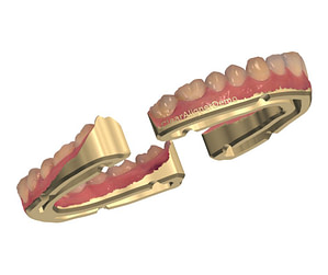 Learn Dental CAD | Institute Of Digital Dentistry