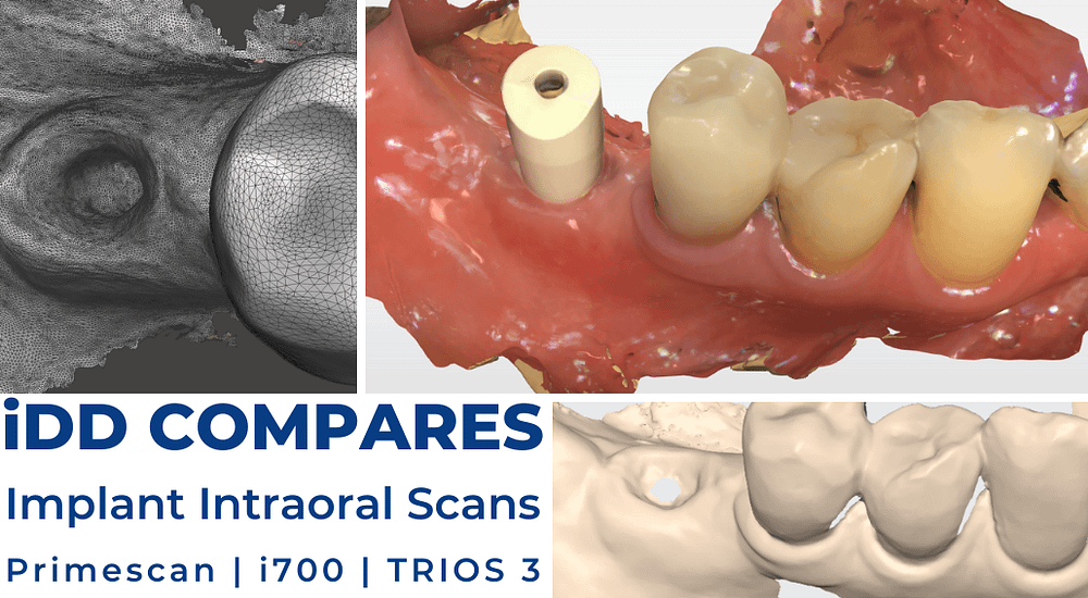 Scan body and implant soft tissue scans taken with Primescan, i700 and Trios 3