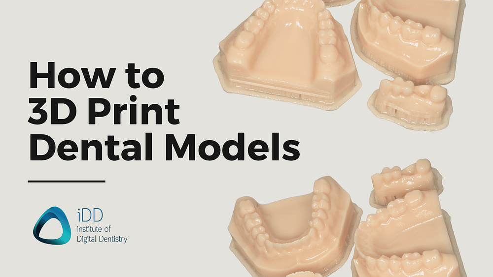 How to 3D Print Dental Models with iDD