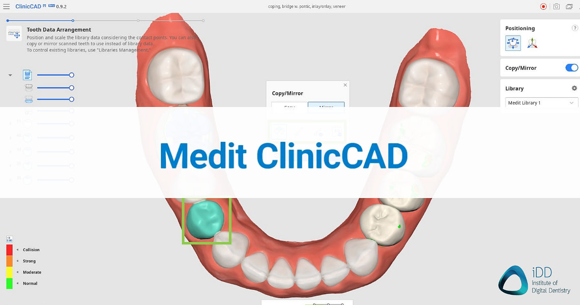 The Ultimate Guide to Dental CAD Software in 2024 Institute of