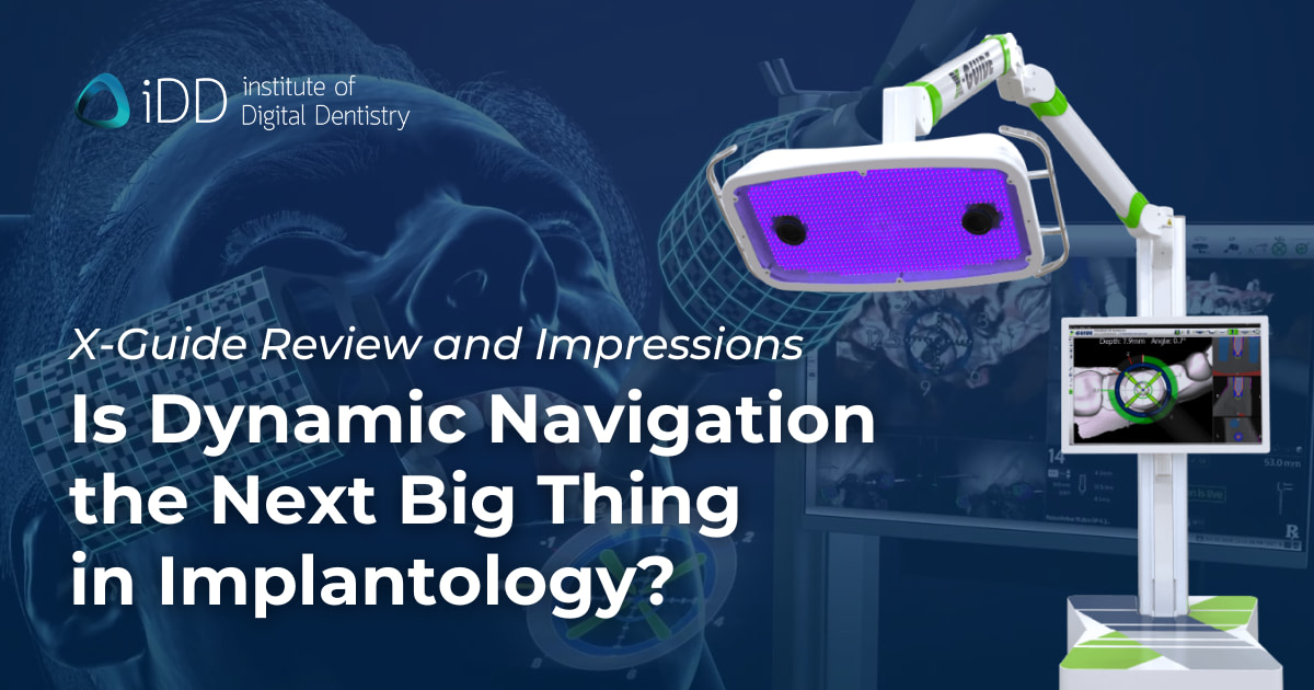 X-Guide Review - Dynamic Navigation for Implantology - iDD
