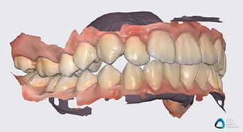 medit link software orthodontic simulator, model base creator, medit i700 institute of digital dentistry (9) 2