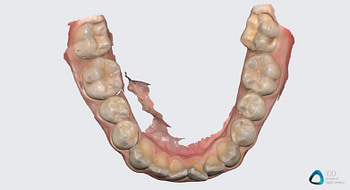 medit link software orthodontic simulator, model base creator, medit i700 institute of digital dentistry (10) 2