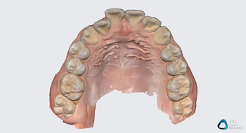 medit link software orthodontic simulator, model base creator, medit i700 institute of digital dentistry (11) 2