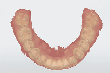 Full-arch-scanning-TRIOS-3SHAPE-TRIOS-4-mandibular-scan-institute-of-digital-dentistry