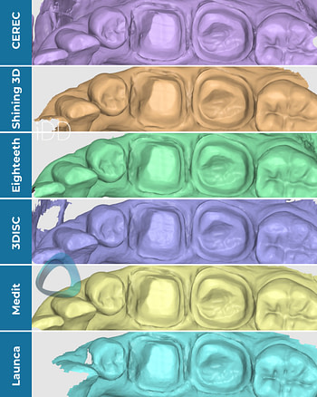 crown-prep-tooth-scan-test-mono-render-Shining-3D-Aoralscan-3-vs-CEREC-Primescan-vs-Helios-600-vs-medit-i700-vs-launca-dl-206p-intraoral-scanner-comparison