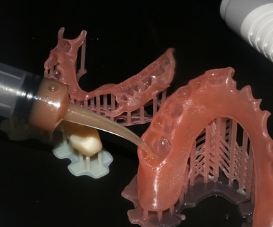 Graphy Tera Herz Flexible Base - Printed Partial Denture Review