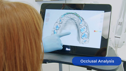 occlusal-analysis-itero-element-5d-plus-unboxing-idd