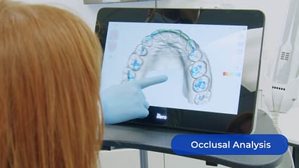 occlusal-analysis-itero-element-5d-plus-unboxing-idd