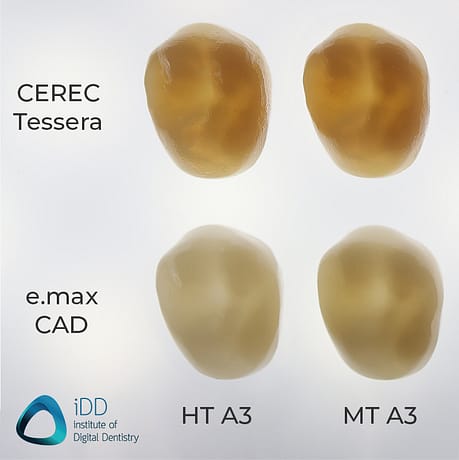 cerec tessera vs emax