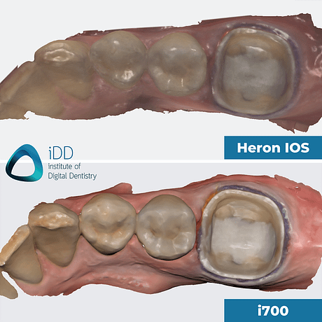 institute of digital dentistry medit i700 and heron IOS iDD