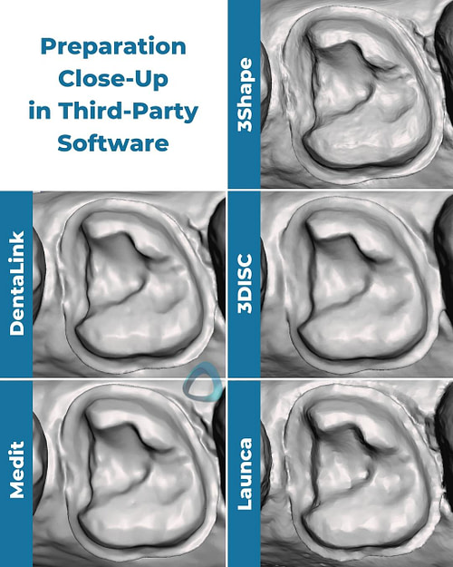 Introducing the Trios 3D Dental Imaging System - Blodgett Dental Care