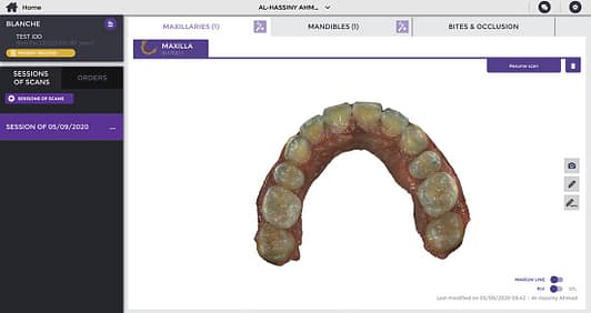 wow scanner software admin intraoral scanner review institute of digital dentistry (2)