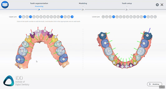 aoralscan-3-review-shining-3d-orthodontic-simulator-model-builder (16)
