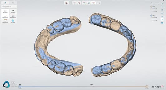 Patient Monitoring 3Shape TRIOS Institute of Digital Dentistry (4)