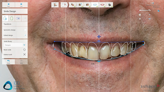3shape smile design institute of digital dentistry iDD (1)