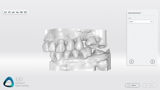 aoralscan-3-review-shining-3d-orthodontic-simulator-model-builder (3)