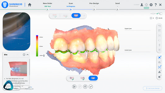 Shining_3D_Aoralscan_3_Review_cost_institute_of_digital_dentistry_ai (71)