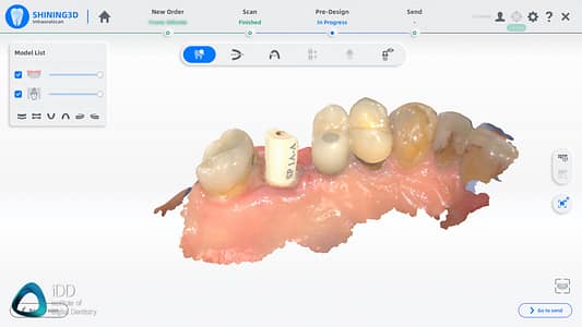 Shining_3D_Aoralscan_3_Review_cost_institute_of_digital_dentistry_ai (97)