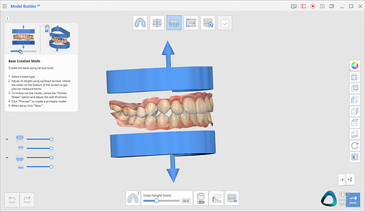 medit link software orthodontic simulator, model base creator, medit i700 institute of digital dentistry (7)