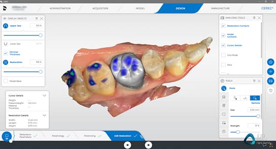 CEREC Primescan review institute of digital dentistry crown design example (1)