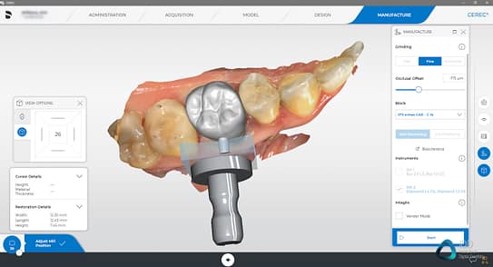 CEREC Primescan review institute of digital dentistry crown design example (2)