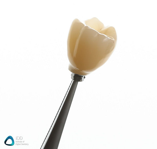 dental implant course institute of digital dentistry (1)
