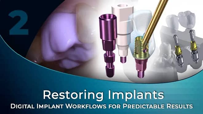 30TgAZqZTI2aFY7gvjRG_Digital Workflows for Implant-Supported Restorations 02 with August de Oliveira