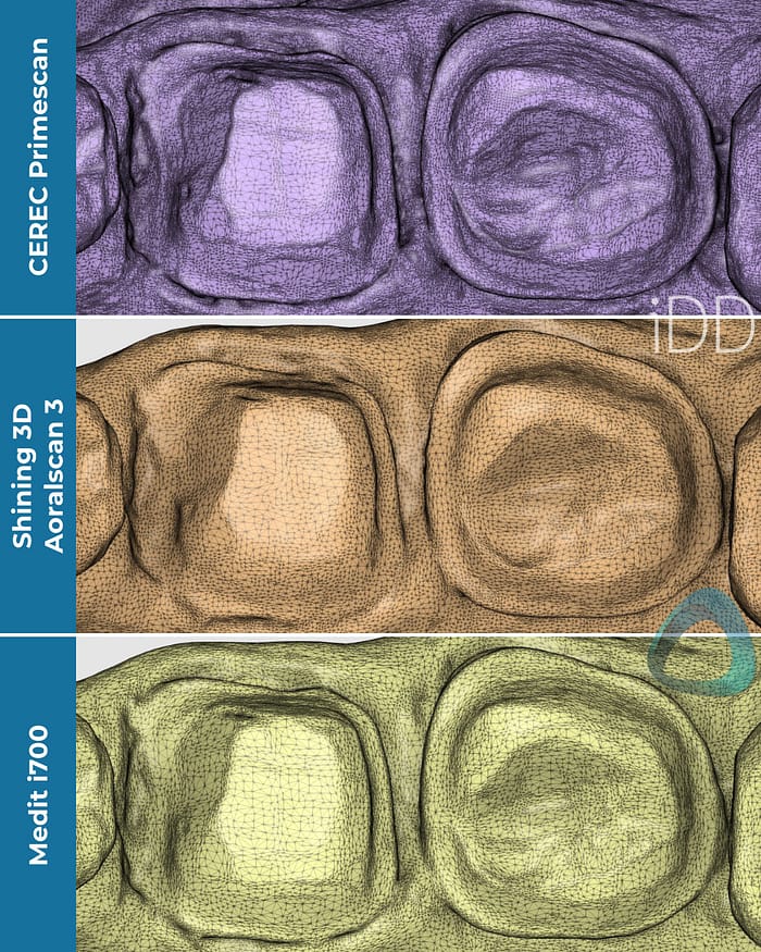 crown-prep-tooth-scan-test-tessellated-mesh-Shining-3D-Aoralscan-3-vs-CEREC-Primescan-vs-Helios-600-vs-medit-i700-vs-launca-dl-206p-intraoral-scanner-comparison