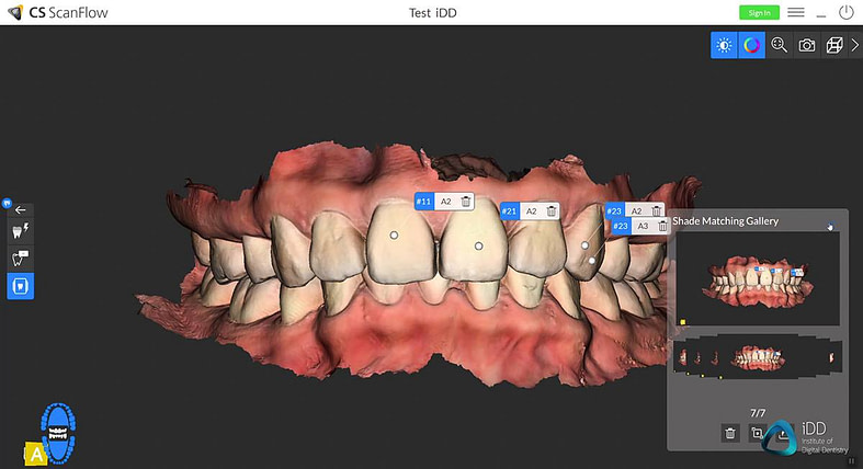 CS scan flow software institute of digital dentistry (1)