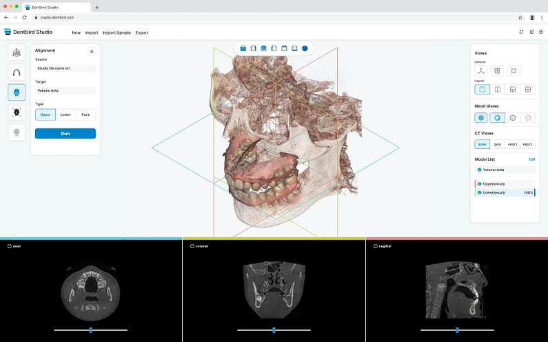 5 Powerful Trends In Digital Dentistry For 2024 You Need To Know   DentbirdStudio2x 