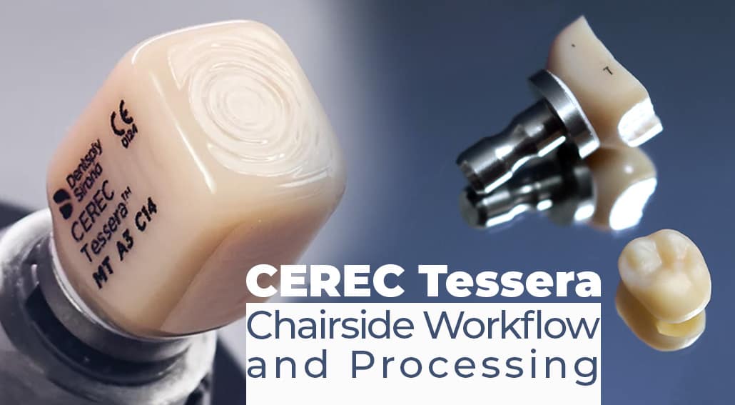 CEREC Tessera Digital Dentistry Blog Online Training & Courses