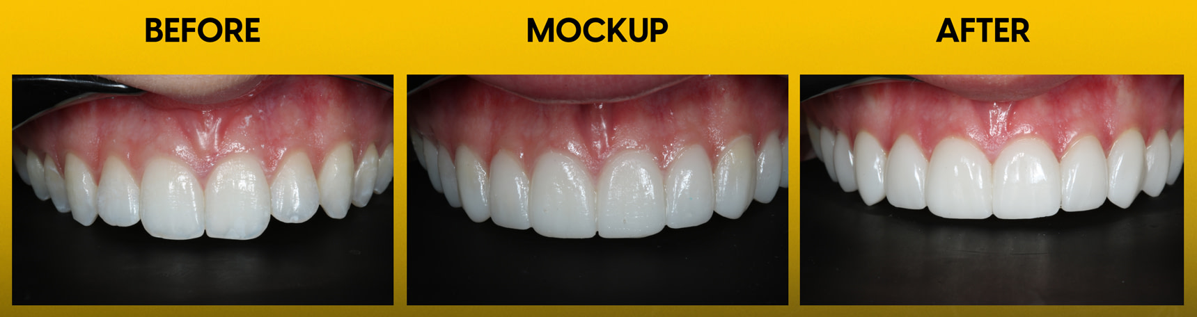 FirstFit-before-mockup-after