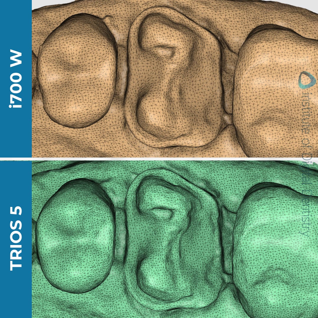 iDD Compares: Medit i700 W vs. 3Shape TRIOS 5 - Institute of Digital ...