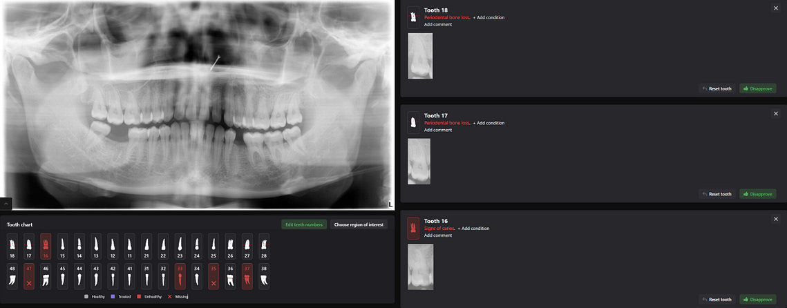 Diagnocat Review - AI Diagnostics of 2D and 3D X-rays in Dentistry