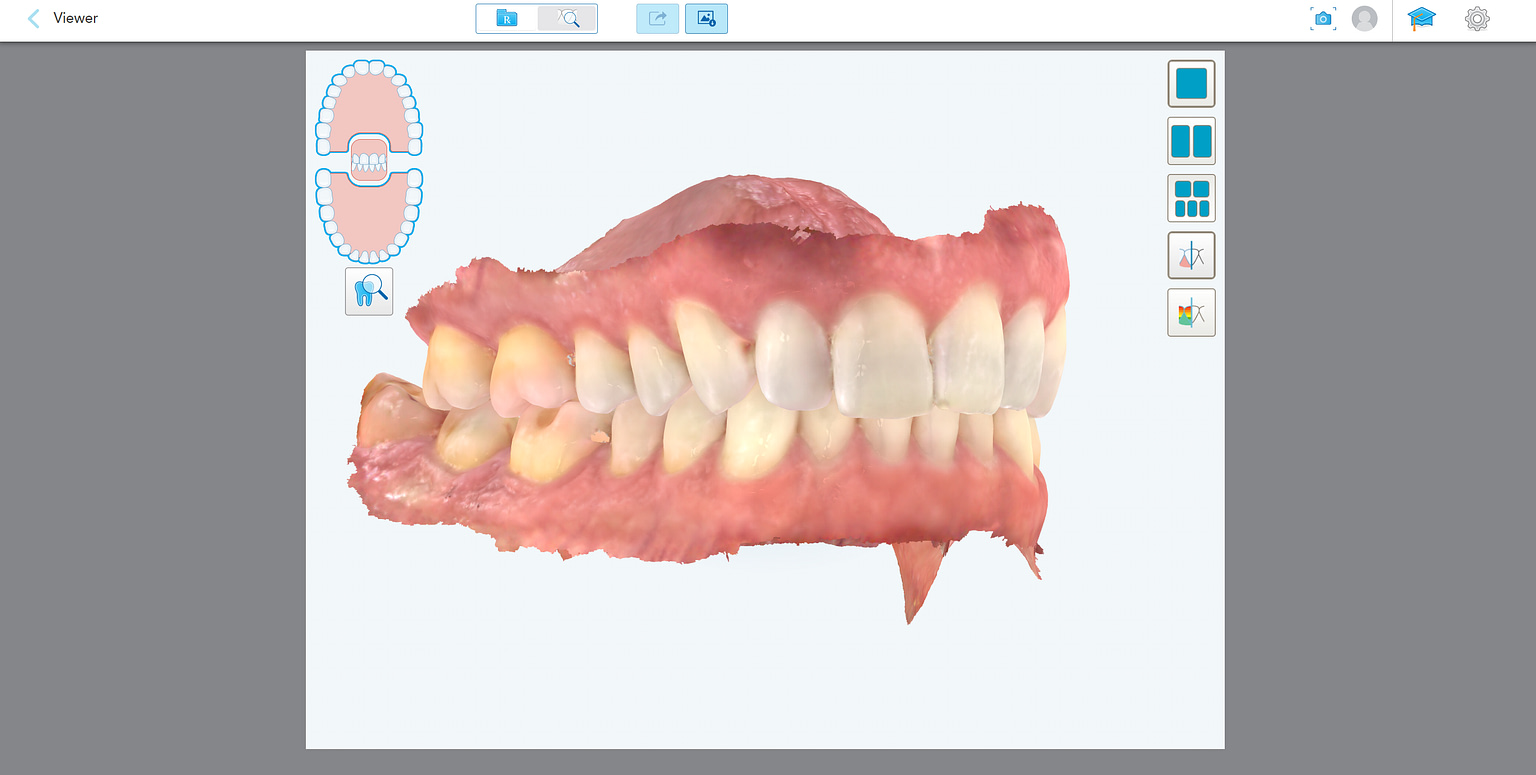 iTero Element 5D Plus Review Digital Dentistry Blog Online Courses